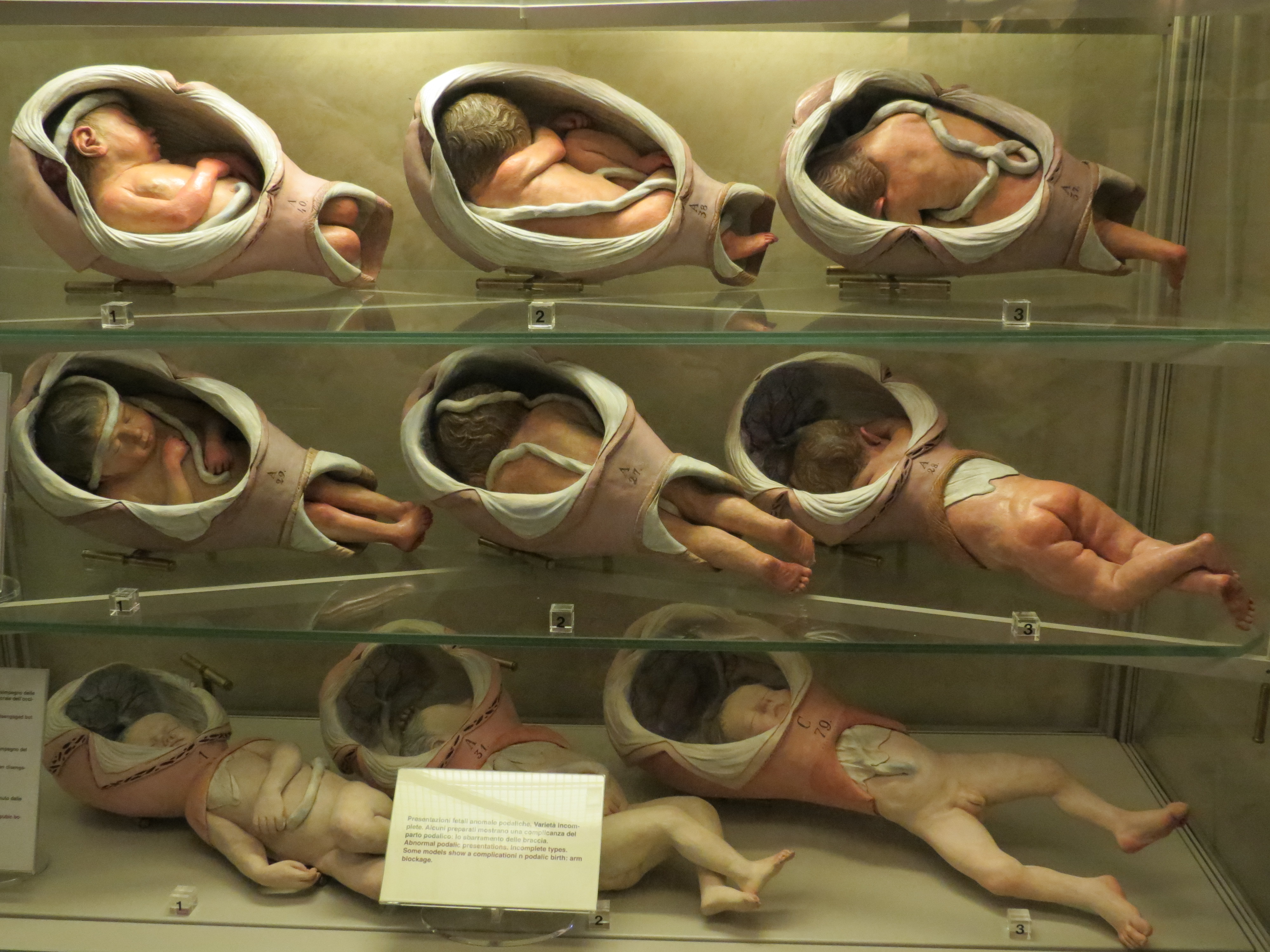 Baby models for obstetrics